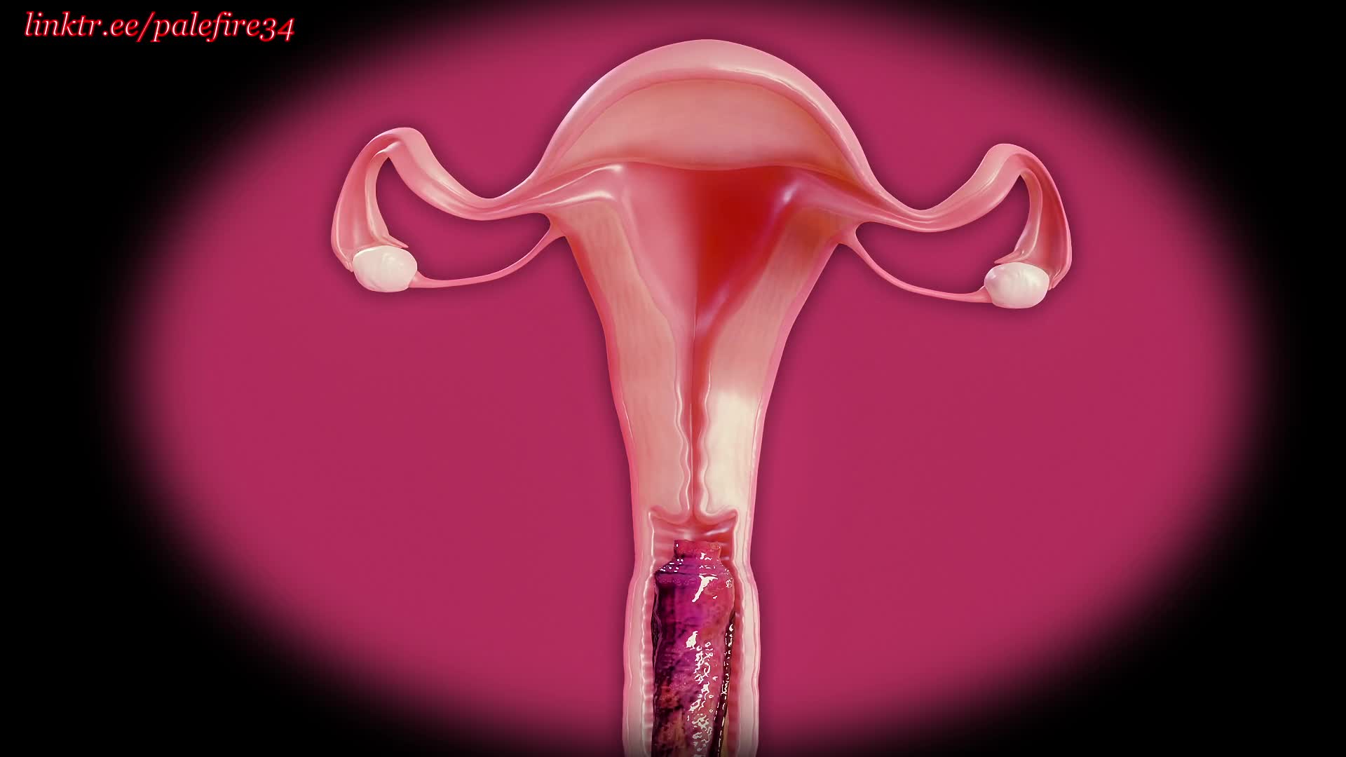 X ray of penis inside vagina